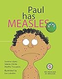 Paul has Measles