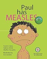 Paul has Measles 1097510573 Book Cover
