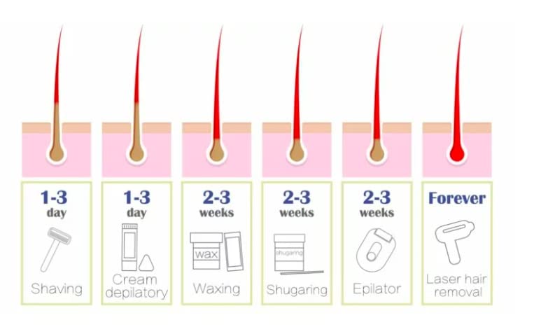 Painless Hair Removal for Men and Women, Crystal Hair Eraser, Matte Black Magic Hair Epilator