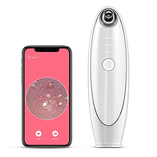 Newentor Blackhead Remover with Built-in Camera