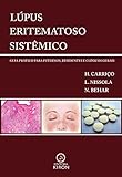 lupus eritematoso sistémico  Lúpus eritematoso sistêmico: guia prático para internos, residentes e clínicos gerais (Portuguese Edition)
