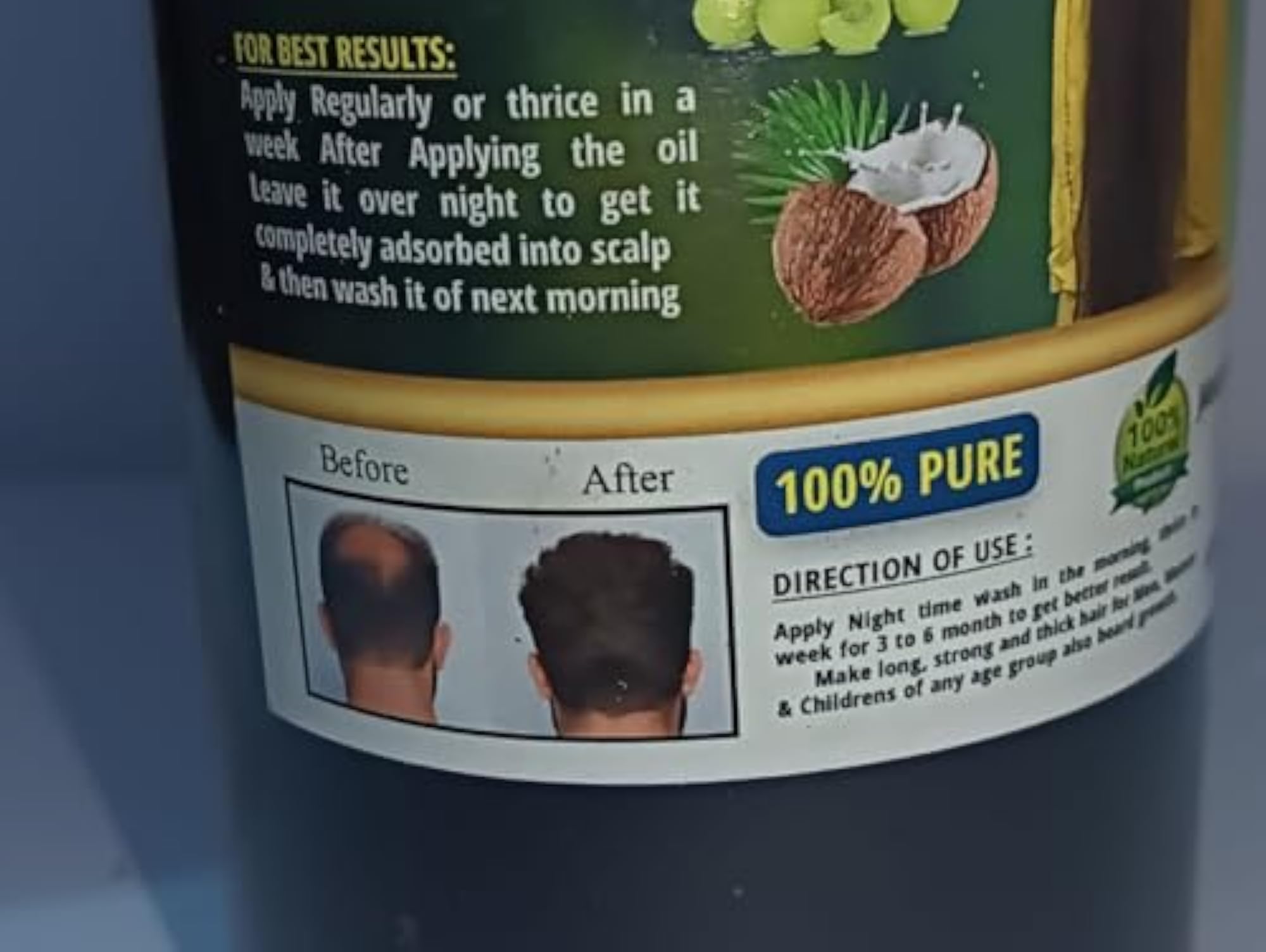 JANAKI ADIVASI Herbal Hair Oil 500 ML