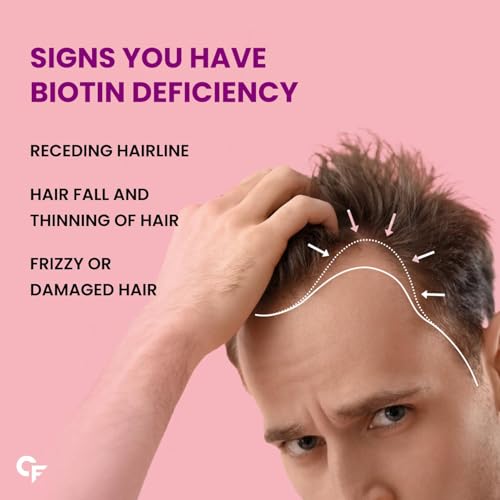Image of Carbamide Forte Biotin Tablets for Hair Growth | Biotin Supplement 10000 mcg | Hair Supplements for Women & Men | 60 Hair Growth Tablets