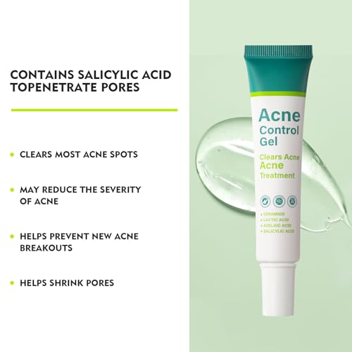 Onkessy Azelaic Acid Serum for Face Acne Treatment, Body Acne Clearing Treatment with 10% Azelaic Acid & Salicylic Acid, Sensitive Skin Care Facial Essential Cream for Recurring Breakouts Refine Pores 30ml