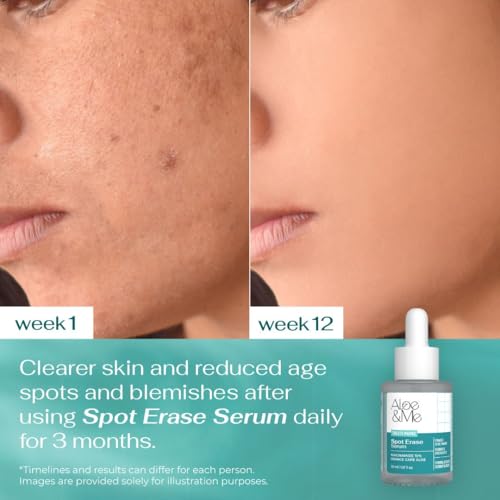 Image of Aloe&Me Spot Erase Serum, 30ml, Clinical Grade Niacinamide 10% with Orange Cape Aloe, Dark Spot Treatment for Normal to Oily Skin