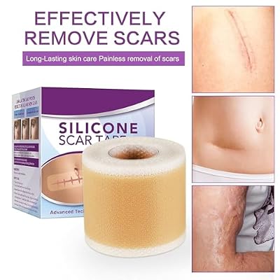 Silicone Scar Tape Roll, 1.6 x 60 Medical Tape for Wound Care Bandages Scars Strips for Surgical Scars Keloid, C-Section, Burns, Injuries Acne, Stretch Marks Removal Sheet Tapes (1.6 x 60)