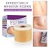 Silicone Scar Tape Roll, 1.6 x 60 Medical Tape for Wound Care Bandages Scars Strips for Surgical Scars Keloid, C-Section, Burns, Injuries Acne, Stretch Marks Removal Sheet Tapes (1.6 x 60)