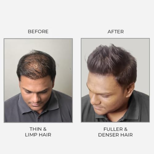 Epitight Store Epitight Thicc Hair Weightless Carb-Based Mousse - Image 4