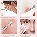 Professional Blackhead Remover Blemish Extractor Tool - Pimple Comedone Removal 2-in-1 Stainless Steel Pimple Popper(2pcs)