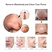 Blackhead Remover Pore Vacuum Extractor