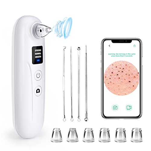 Anttctig Blackhead Remover Vacuum, Electric Acne Comedone Whitehead Extractor Tool, USB Rechargeable Blackhead Pore Vacuum Cleaner Kit with 3 Suction Modes, 6 Probes, for Women & Men