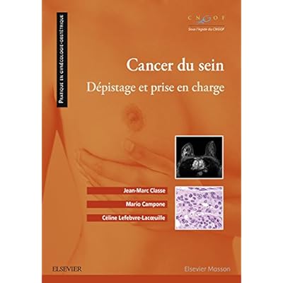 Cancer du sein
