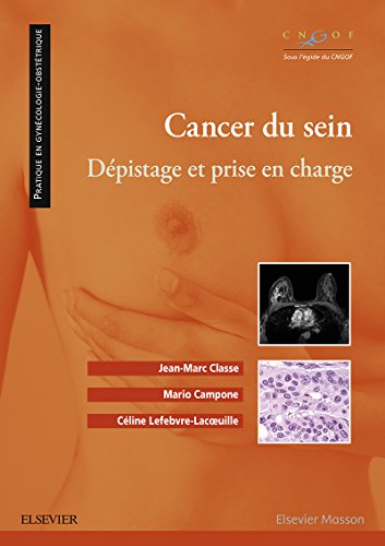  Cancer du sein: Dépistage et prise en charge (Pratique en gynécologie-obstétrique) Livre PDF Gratuit