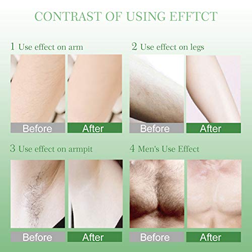 Hair Inhibitor, Hair Stop Growth Spray, Hair Removal Spray, Painless Hair Removal Inhibitor, for Face, Arm, Leg, Armpit, Permanent Hair Removal - Thumbnail 6
