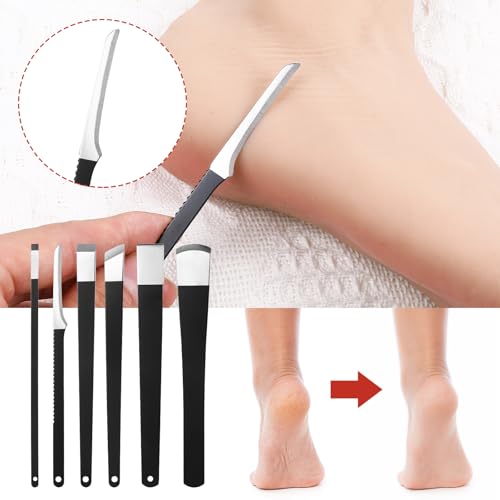 cobee 6 Stück Eingewachsene Zehennägel Set, Edelstahl Pediküre Messer Kits Mit Aufbewahrungsbox, Hornhautentferner Hornhauthobel Fußschaber Pediküre Messer Kits Fußpflege Werkzeuge für Hand Füße