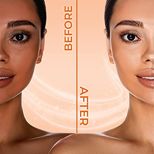 Carotïs Carotis, Skin Brightening Cream – 300Ml / 10.14Fl Oz – 7 Day Night Cream For Uneven Skin Tone, With Vitamin A #TOP6