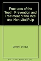 Fractures of the Teeth: Prevention and Treatment of the Vital and Non-Vital Pulp 0812109546 Book Cover