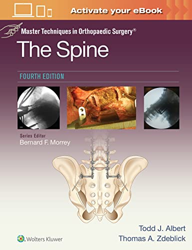 Master Techniques in Orthopaedic Surgery: The Spine