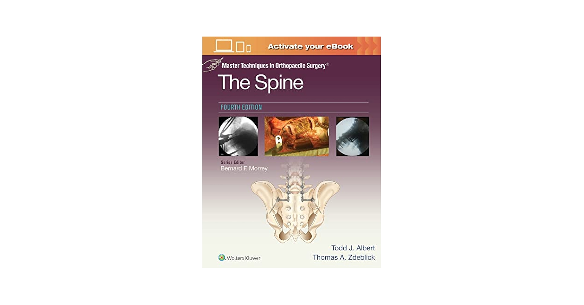 Master Techniques in Orthopaedic Surgery: The Spine