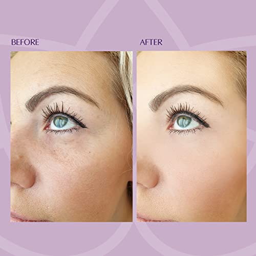 Beverly Hills, Siero Miracoloso Ringiovanente e