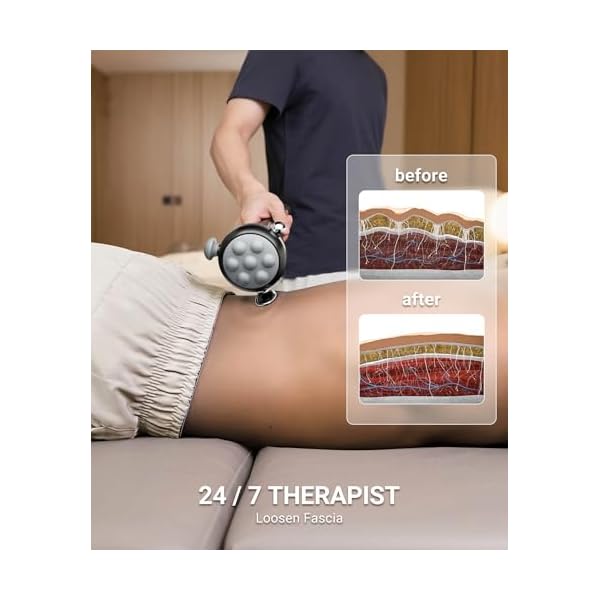HYAKO Pro R1 Max Therapy Massager-120 Hz Pro-Grade Deep Tissue Vibration - Image 3