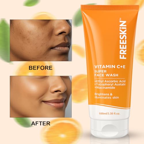 Image of Freeskin Vitamin C & E Supar Face Wash with Niacinamide, Ethyl Ascorbic Acid & Tocopheryl Acetate - Brightens, Illuminates & Evens Skin Tone, Reduces Dark Spots & Improves Skin Radiance, 100ml