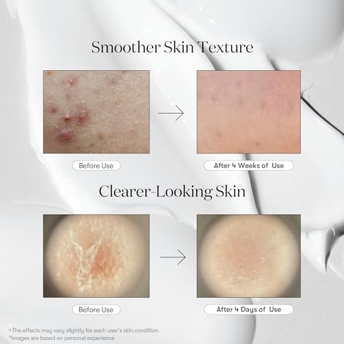 Graphic showing the Reedle Shot being suitable for all skin types, including sensitive and blemish-prone