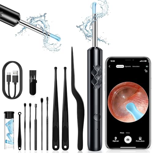 KIEUIENK Ear Wax Removal Tool Camera, Easy and Safe Ear Cleaner, Earwax Removal Cleaning Kit with 6 Ear Pick, 10 Pcs Earwax Remover Set, 1296P HD Ear Camera Removal Tool for iOS & Android, A2.Black