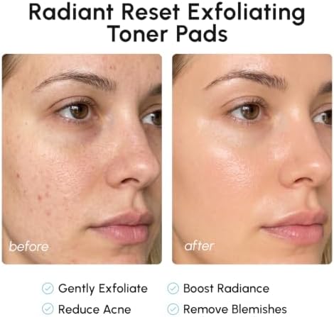 MAREE Glycolic Acid Pads - Toner Pads for Face Cleansing - Exfoliating Pad with Tea Tree Oil, Salicylic Acid & Vitamins E, B3, B5 - Facial Polishes & Peels, Skin Pore Resurfacing & Radiance - 50 Count - 4