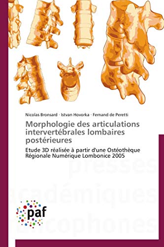 Morphologie des articulations intervertébrales lombaires postérieures: Etude 3D réalisée à partir d'une Ostéothèque Régionale Numérique Lombonice 2005 (Omn.Pres.Franc.) (French Edition)