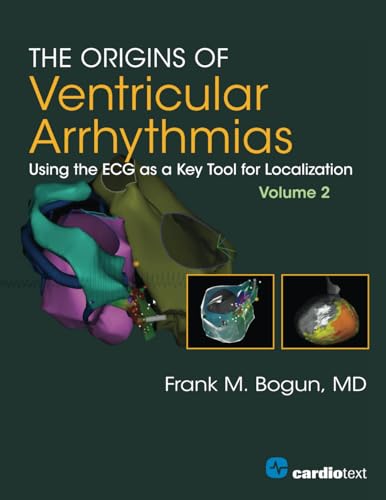 The Origins of Ventricular Arrhythmias: Using the ECG as a Key Tool for Localization