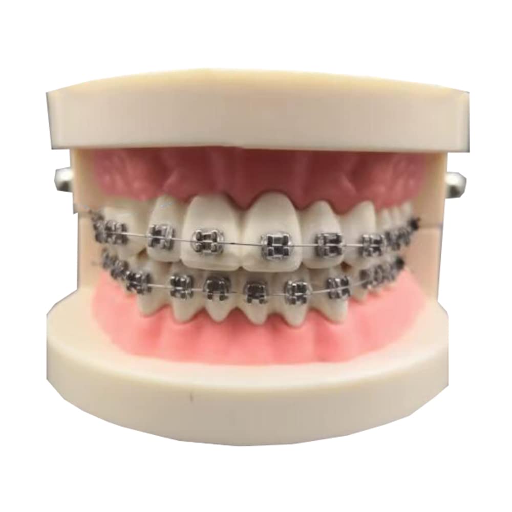 Modello di Simulazione dei Denti orali - Modello dimostrativo ortodontico Dentale - Modello di Trattamento dei Denti dentali con Attacco Metallico, Modello esplicativo dell'ar,B
