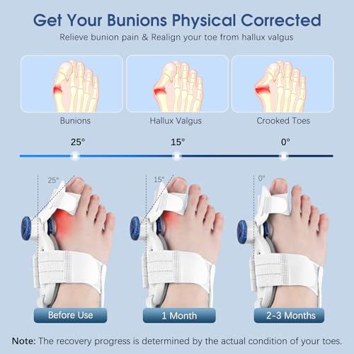 Image of KASHEVI Bunion Corrector for Women & Men Big Toe - Bunion Fix with Big Toe Separator for Toes Alignment - Adjustable Orthopedic Bunions Splint with Straightener for Pain Relief, Hallux Valgus Correction(White)
