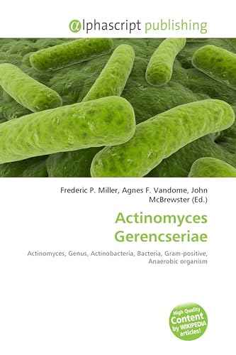 Actinomyces Gerencseriae: Actinomyces, Genus, Actinobacteria, Bacteria, Gram-positive, Anaerobic organism