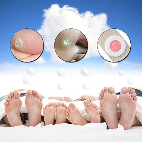 Tomshin 36Pçs / Box Foot Remoção de Milho Gesso com Buraco Verrugas Espinho Pés Remoção de Calos Rem