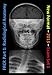 FRCR Part 1: Radiological Anatomy - New for 2013 - Set 1