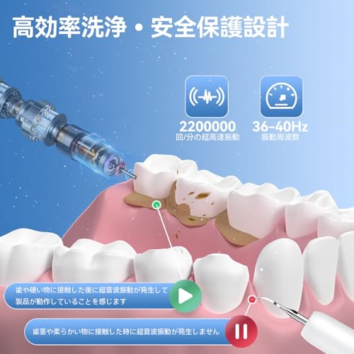 BESTEK 超音波歯クリーナー BTT4 の商品画像 4