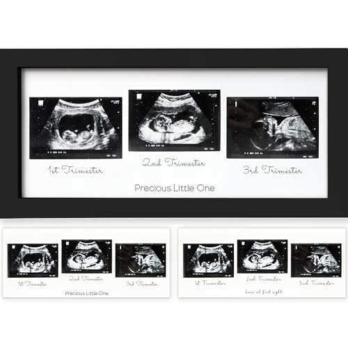 Image of KeaBabies Baby Sonogram Picture Frames - Trio Ultrasound Picture Frames, First Time Mom Gift, Cute Pregnancy Reveal Photo Frame, Baby Gender Reveal Gift,Newborn Nursery Decor(Onyx Black)
