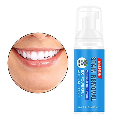 NC Professional Espuma de clareamento dental para limpeza bucal refrescante, 4 x 4 x 13,5 cm
