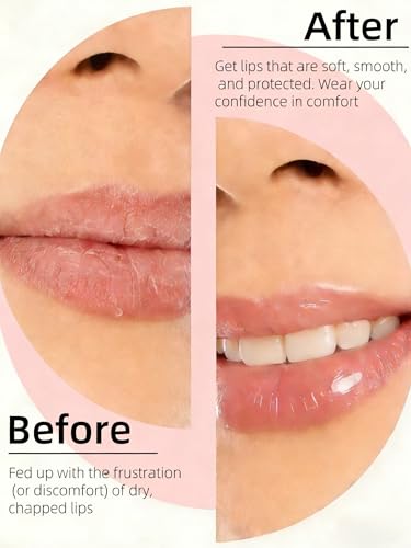 Vegan Summer Lip Balm for Dry Lips with Shea Butter & Olive Oil - Image 3