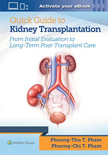 Quick Guide To Kidney Transplantation #TOP6