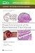 Biopsy Interpretation of the Gastrointestinal Tract Mucosa Volume 2: Neoplastic: Print + eBook with Multimedia (Volume 2)