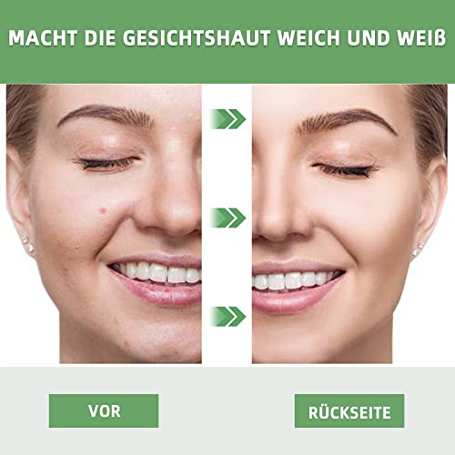 Green Mask Stick,Grüner Tee Clay Maske, Tiefenreinigung zur Ölkontrolle Mitesser Entfernen,Befeuchtet und kontrolliert… - Image 5
