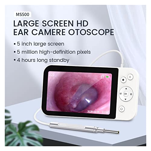 Limpieza de la oreja visual con pantalla LCD para evitar daños en el oído 3