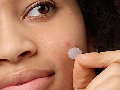 FAST ACTING SPOT PATCHES by Chéz Foxy. Breakout Pimple Patches (pack of 36) Invisible Hydrocolloid Acne Patches - Image 2