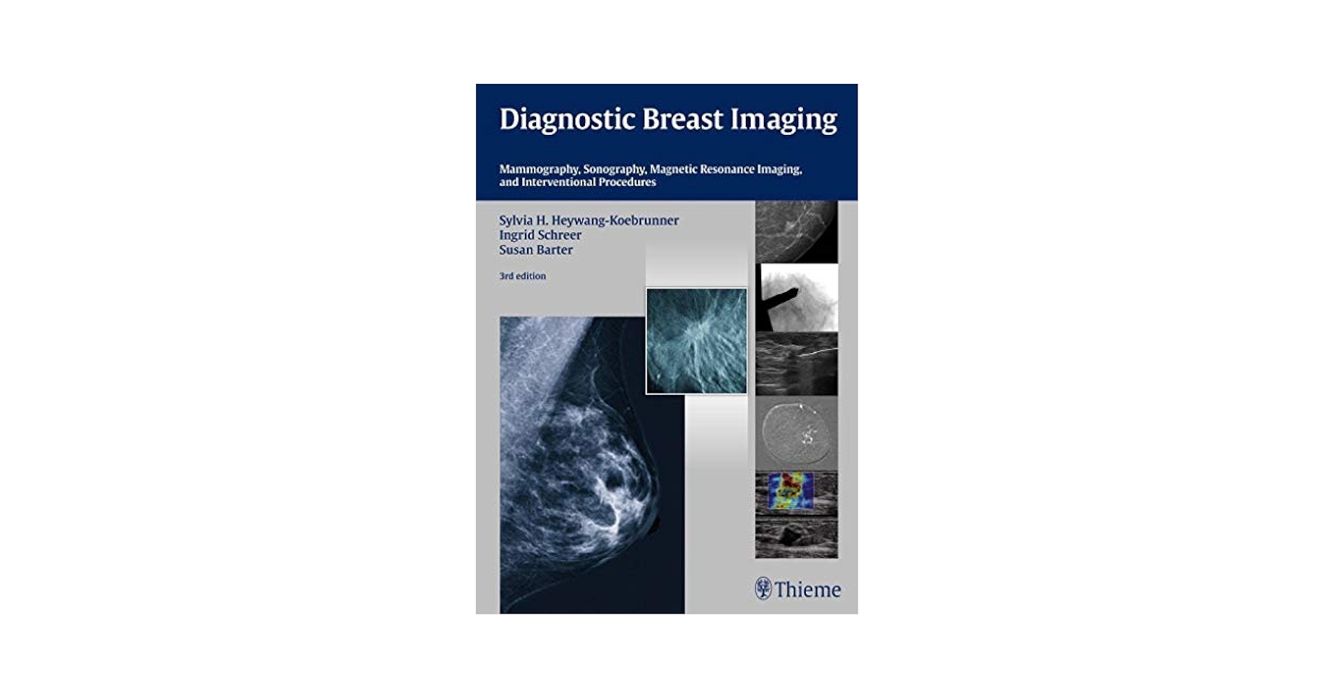 Diagnostic Breast Imaging 第2版 Diagnostic Breast Imaging: Mammography, Sonography, MRI and