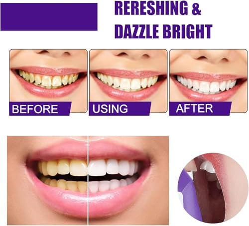 Image of Purple Toothpaste for Teeth Whitening: Best Color-Correcting Foam Toothpaste for Stain Removal - Sensitive Teeth Brightening & Non-Peroxide Whitening - for Adults1.5 fl oz