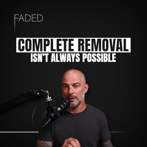 『How Laser Tattoo Removal Works』のカバーアート
