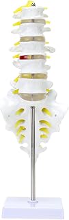 MIIRR Life Size Lumbar Spine Anatomical Model with A Herniated Disc at L4, Lumbar Spine Model with Sacrum and Spinal Nerves