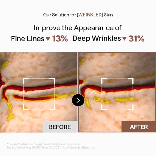 Image of Mediheal Retinol Collagen Under Eye Patches - Korean Hydrogel Eye Pads (60 patches) with 95% Retinol & 5 Micro Collagen. Nourishing & Non Irritating Eye Gel Mask. Sealing Cap & Spatula Included.
